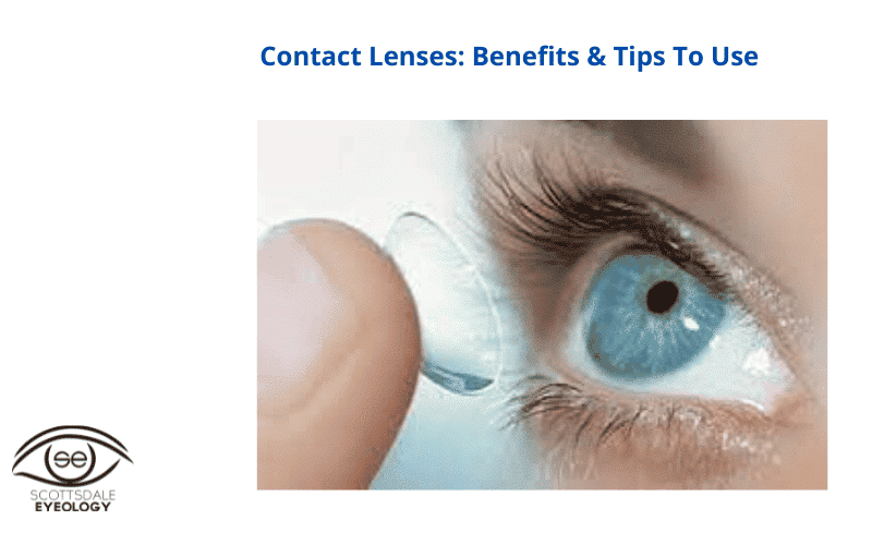 contact lenses in scottsdale