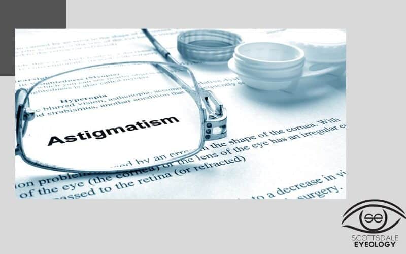 Astigmatism-Treatment
