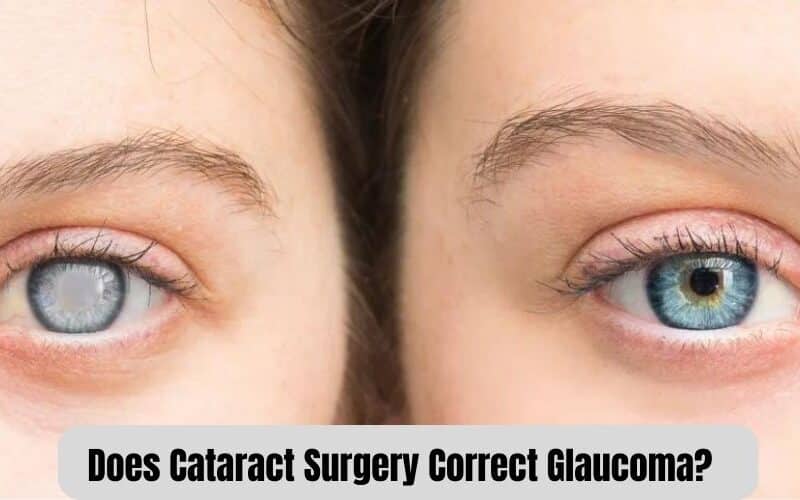 Cataract-Surgery-And-Glaucoma